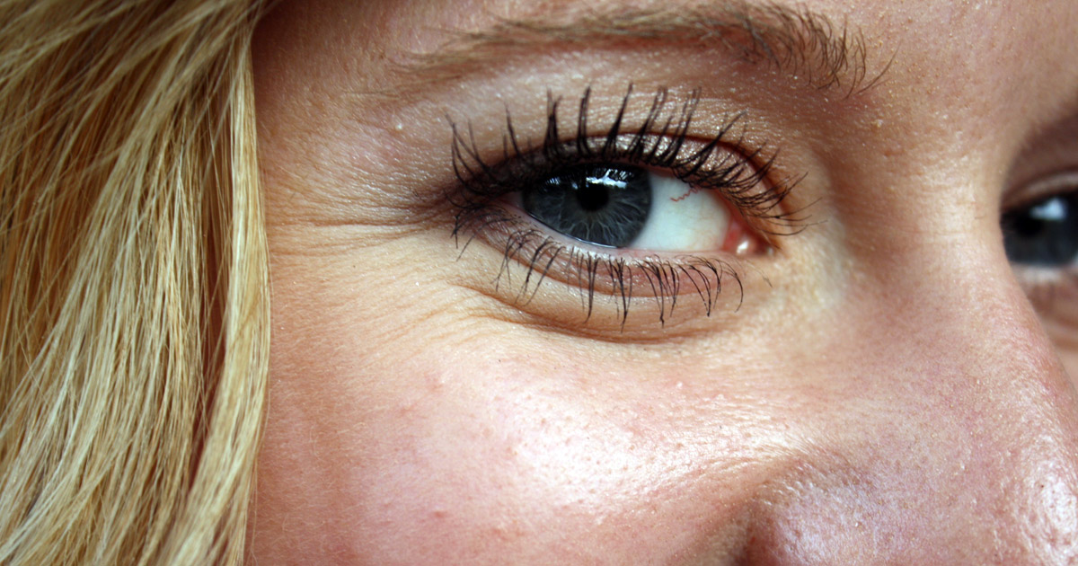 closeup of wrinkles around a woman's eye