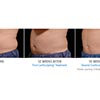 abdomen 12 and 15 weeks male, your results may vary