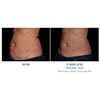 abdomen 12 weeks female, your results may vary