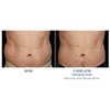 abdomen 12 weeks male, your results may vary