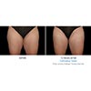 inner thighs 13 weeks female, your results may vary