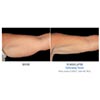 underarm 10 weeks female, your results may vary