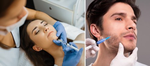 patients receiving chin filler injections.