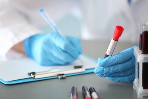 Person holds a vial of blood with one hand while writing on a clipboard with the other.