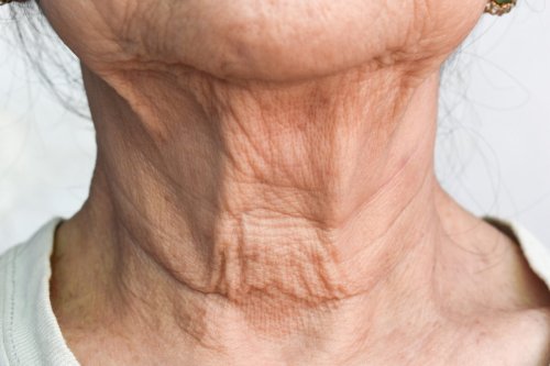 pliegues en la piel del cuello de mujer mayor.