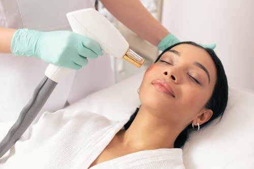 phụ nữ nhận điều trị laser trên mặt.