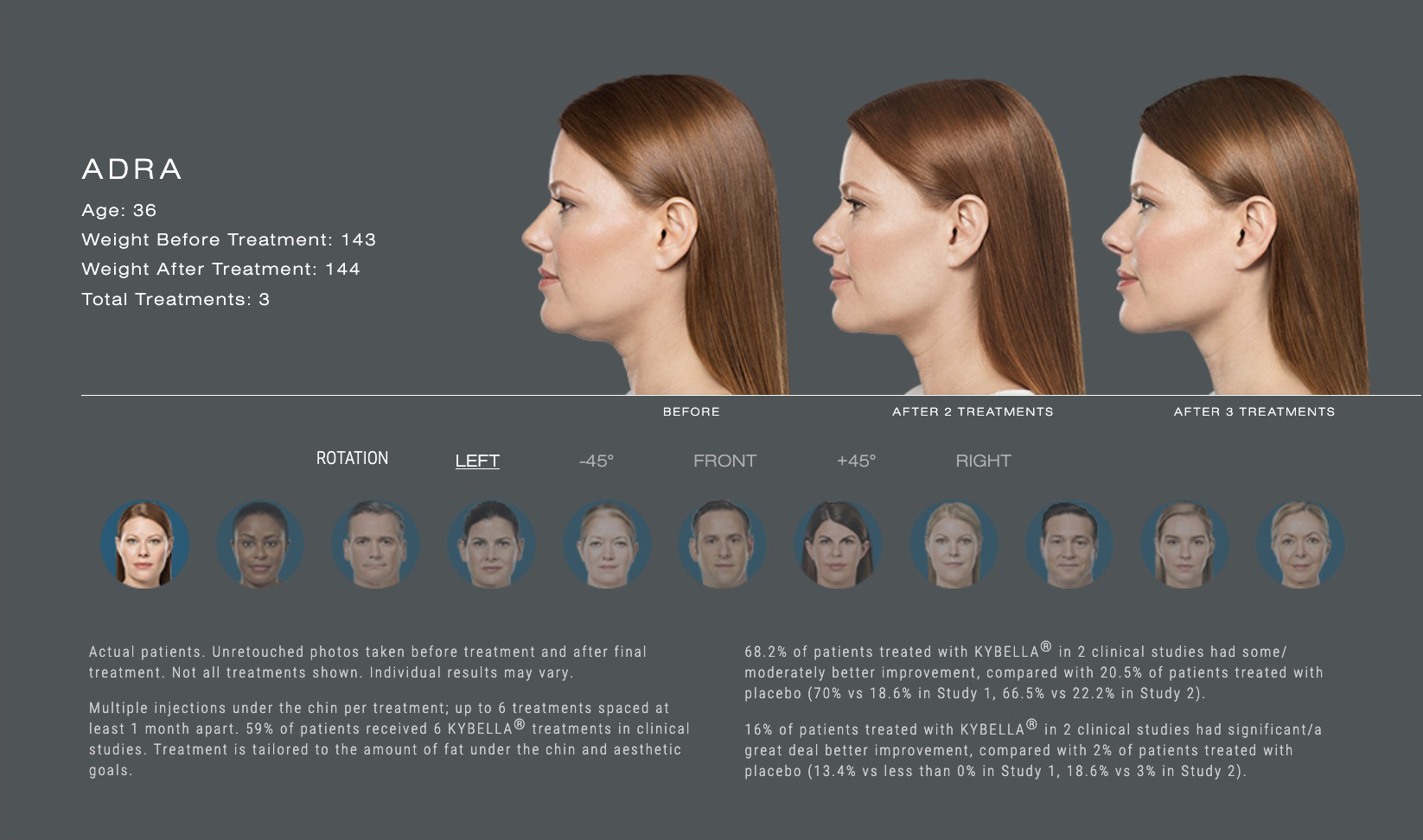 example of before and after